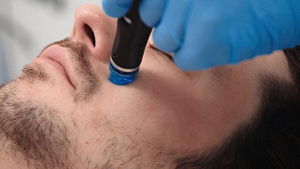 HydraFacial treatment