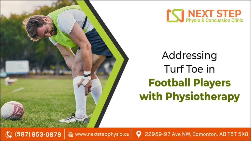Addressing Turf Toe in Football Players with Physiotherapy