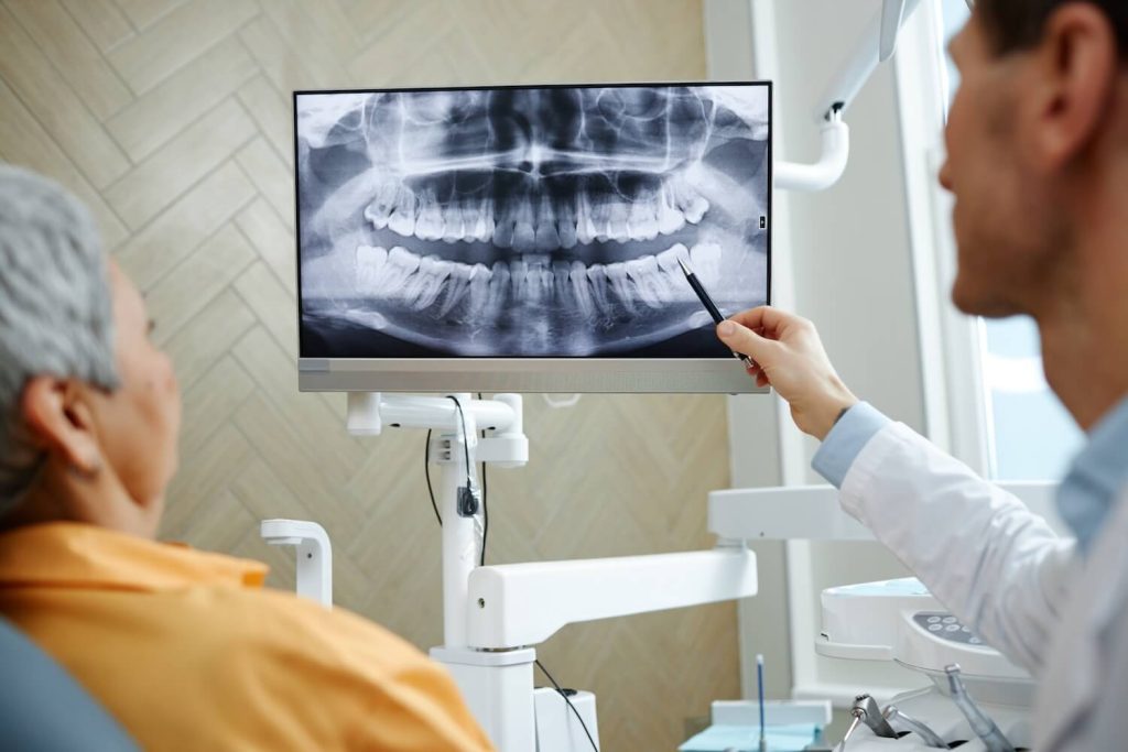 Beyond the Surface Why Dental X Rays Are Essential for Your Oral Health