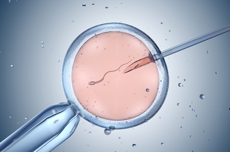 Understanding Intracytoplasmic Sperm Injection (ICSI) at Liv Hospital icsi procedure