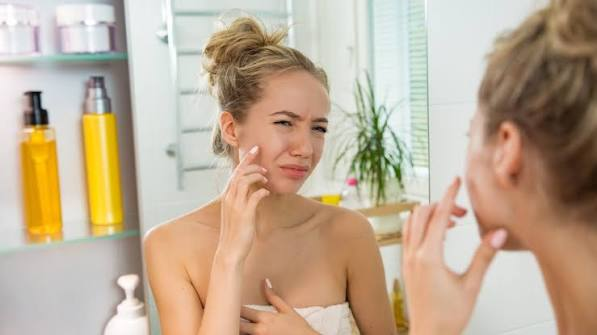 How to Calm Redness and Irritated Skin Fast image 4285