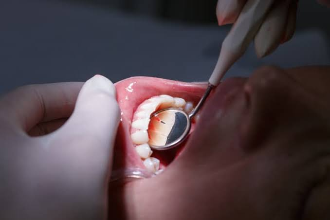 Why General Dentistry Is Key To Maintaining Healthy Gums image 5593